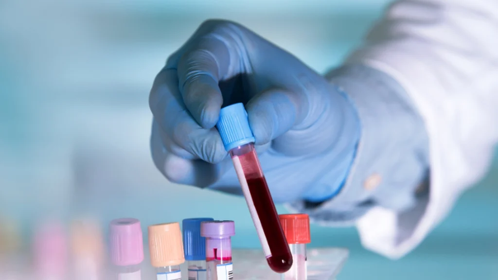 Wissenschaftler bestätigen: Menschen mit dieser Blutgruppe altern langsamer