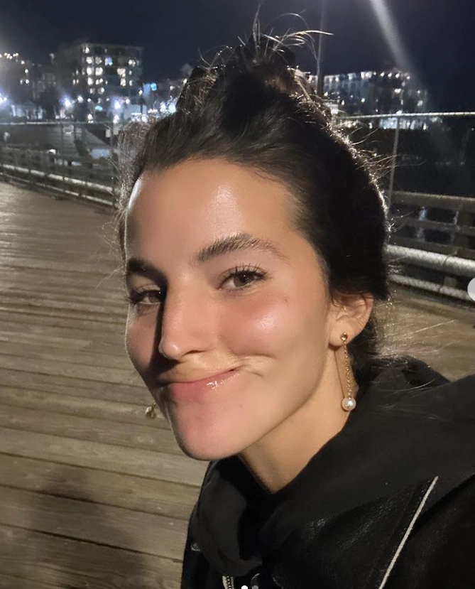 Model verliert Lippe durch Hundebiss: Wie ein Model nach Verlust ihrer Lippe strahlt