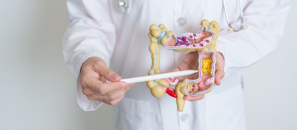 Darm-Polypen: 7 Symptome, die Sie kennen sollten, um Krebs vorzubeugen