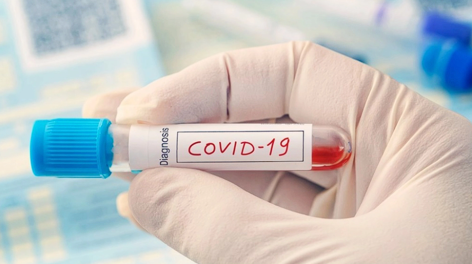 Neue Erkenntnisse: COVID-19 Fördert die Ansammlung von ‚Zombie-Zellen‘ im Gehirn