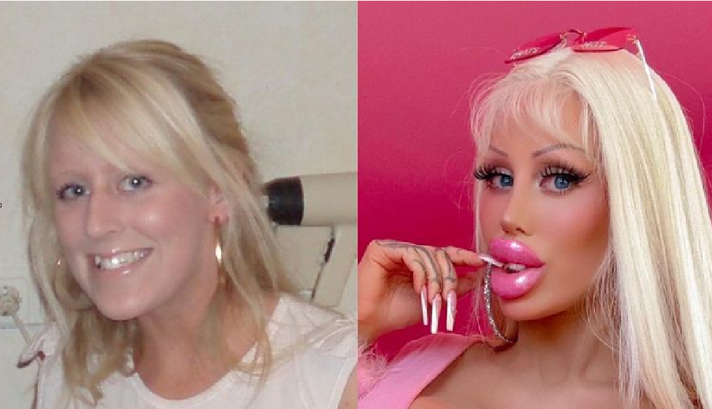 Frau gibt über 100.000 Euro aus, um sich in eine menschliche Barbie zu verwandeln