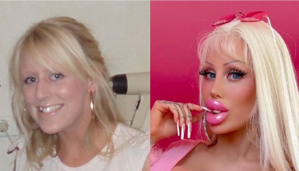 Frau gibt über 100.000 Euro aus, um sich in eine menschliche Barbie zu verwandeln