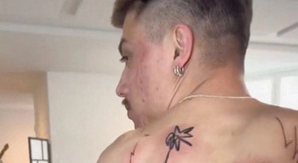 Mann zahlte 940 Euro für ein Rücken-Tattoo: Leute meinen, es sieht aus wie eine Kinderzeichnung