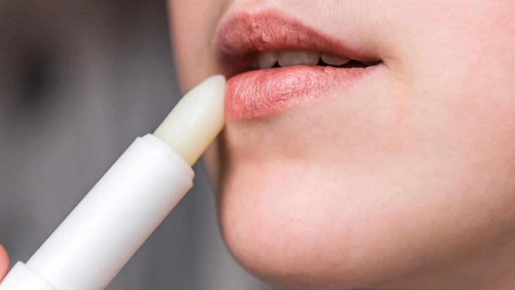 Trockene Lippen: Vorbeugung und Behandlung